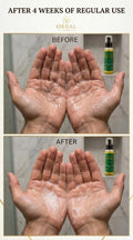 Orbal Care Anti Hairfall Oil